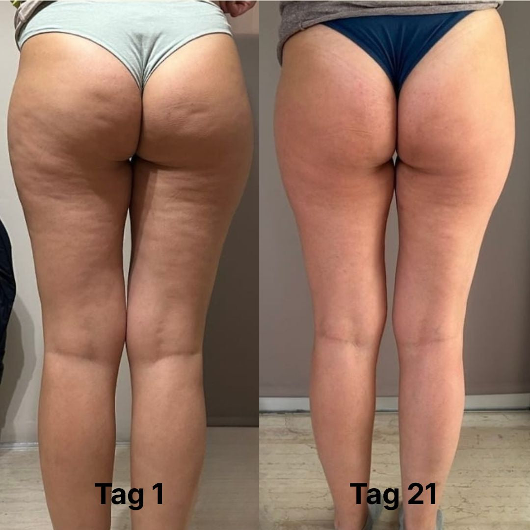 CelluLuxe PRO - THE ORIGINAL