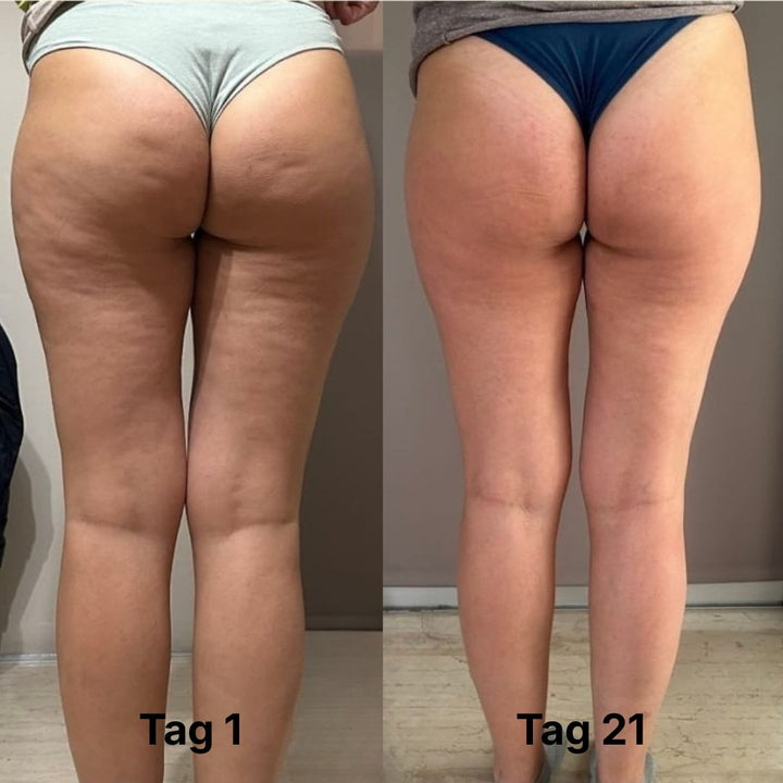 CelluLuxe PRO - THE ORIGINAL