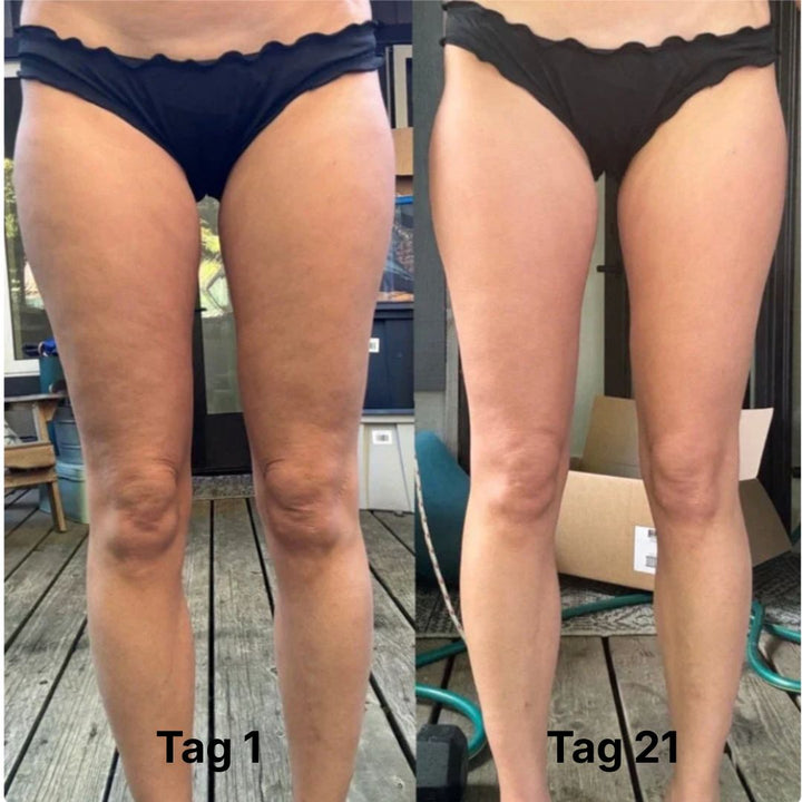 CelluLuxe PRO - THE ORIGINAL