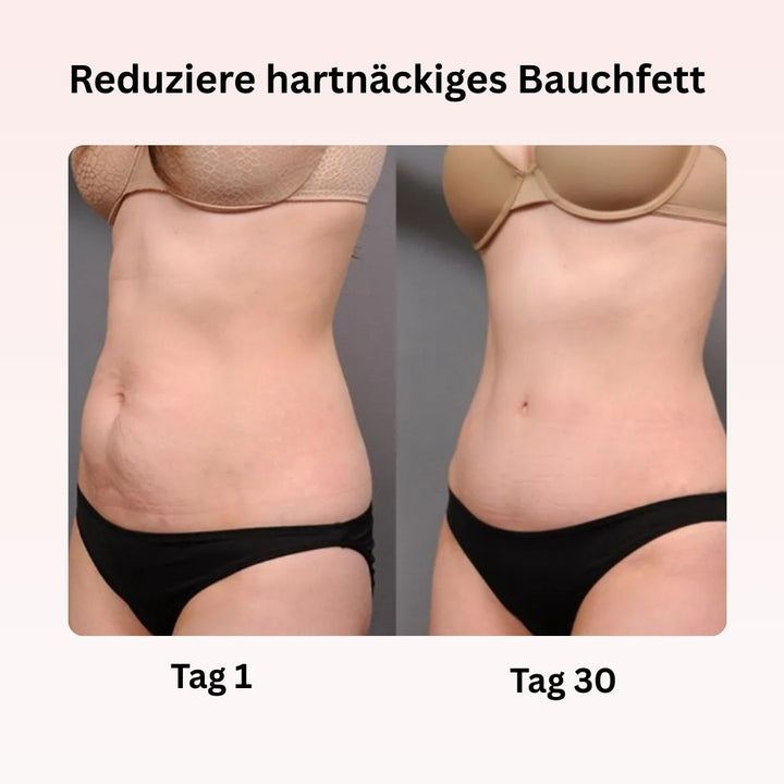 CelluLuxe PRO - THE ORIGINAL